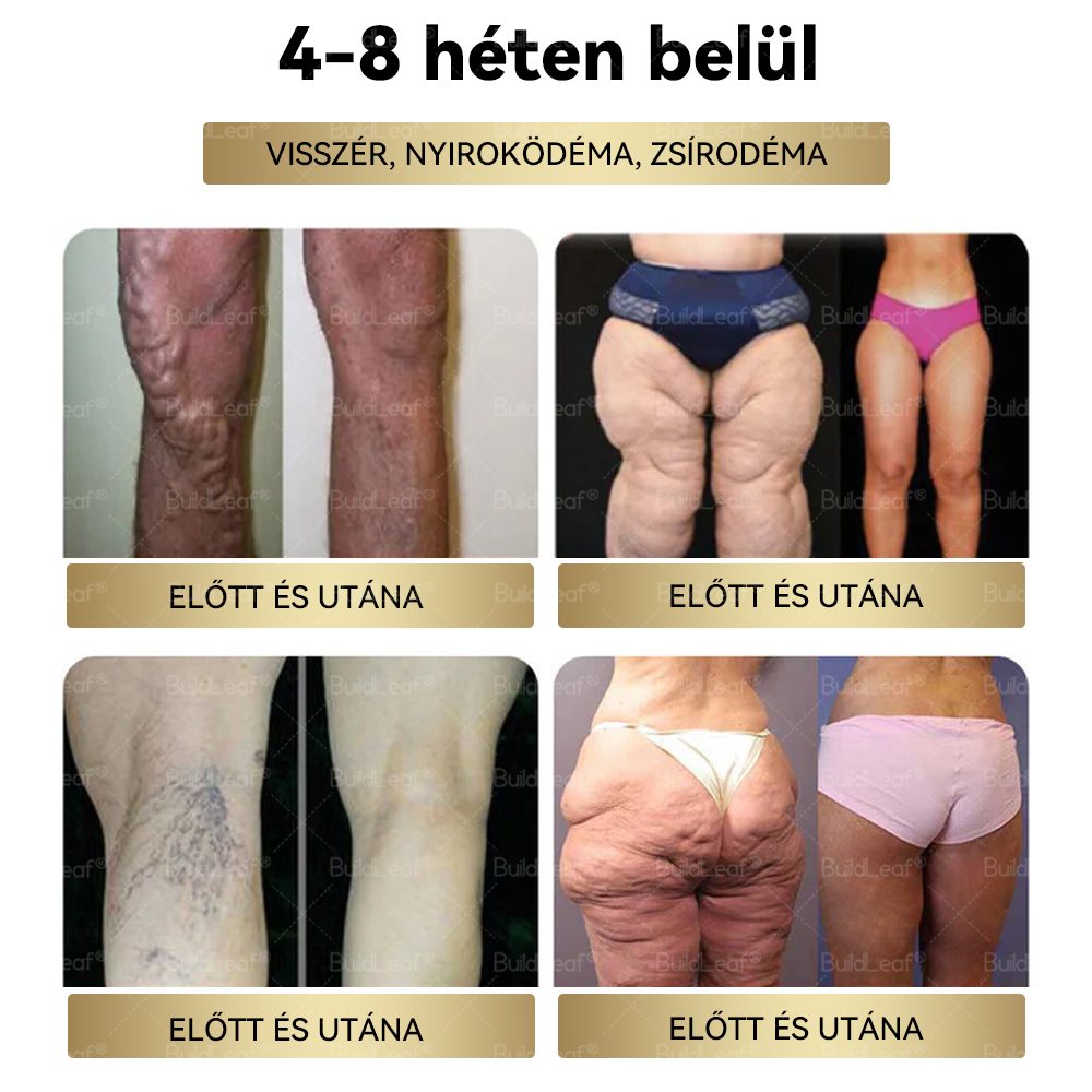 Már csak 5 üveg maradt! További 50% kedvezmény! Szerezd vissza az alakod és egészséged! Ha most kihagyod ezt a lehetőséget, jövőre már lehet, hogy túl késő lesz! 💥🔥