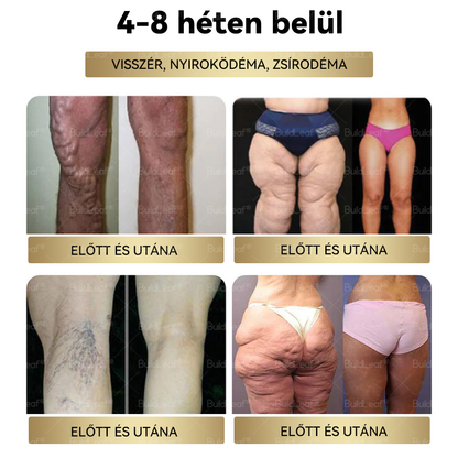 Már csak 5 üveg maradt! További 50% kedvezmény! Szerezd vissza az alakod és egészséged! Ha most kihagyod ezt a lehetőséget, jövőre már lehet, hogy túl késő lesz! 💥🔥